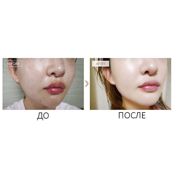 Стойкий ББ крем-бальзам с матовым финишем Dr.Ceuracle Recovery BB Balm SPF 28 PA++
