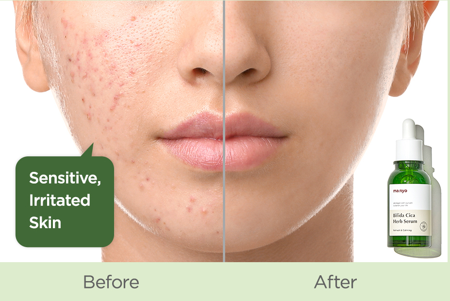 Сыворотка успокаивающая с комплексом центеллы и бифидобактериями Manyo Bifida Cica Herb Serum, 50 мл