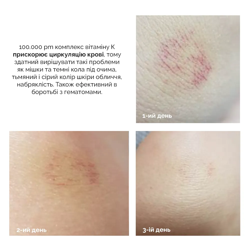 Ампула с липосомальной формулой витамина К Dr. Ceuracle PLC Vita K Liposome Oil Ampoule, 50 мл