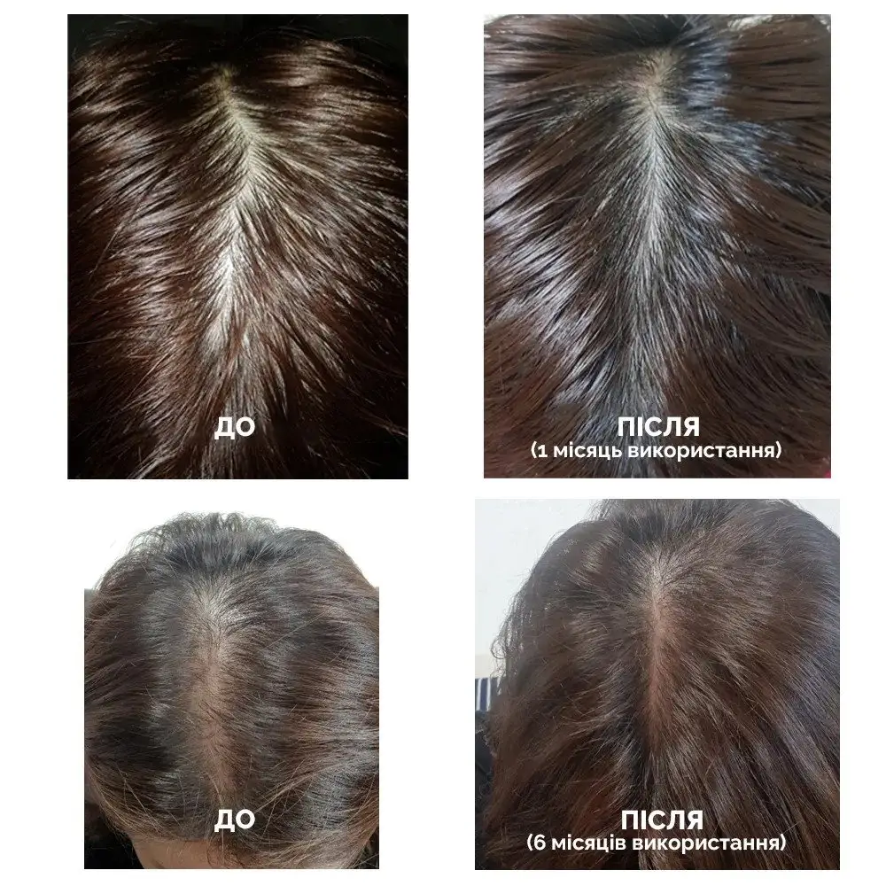 Стимулирующий тоник для роста волос Dr.Forhair Folligen Tonic, 120 мл