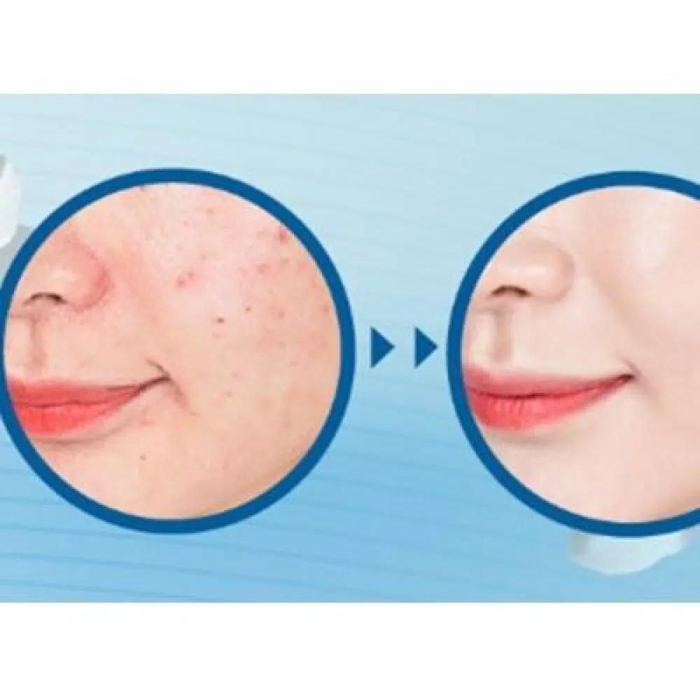 Кушон зі змінним блоком Cuskin Clean-up Skinfit Cushion Pact (SPF 50+/PA+++), 15г.+15г.
