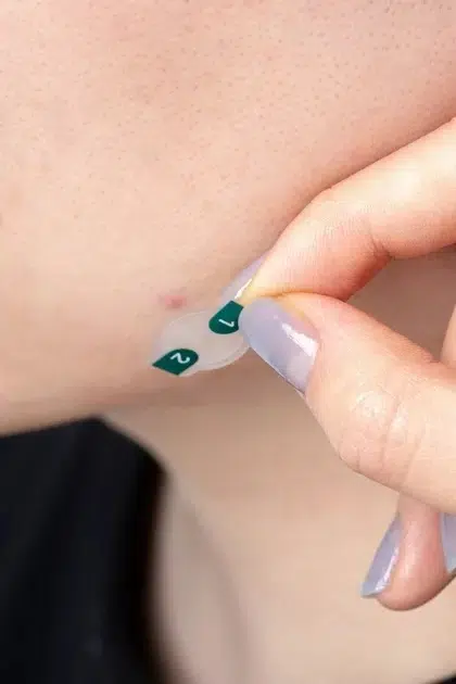 Патчі від прищів SKIN and LAB Clean and Easy Blemish Patch, 54 шт