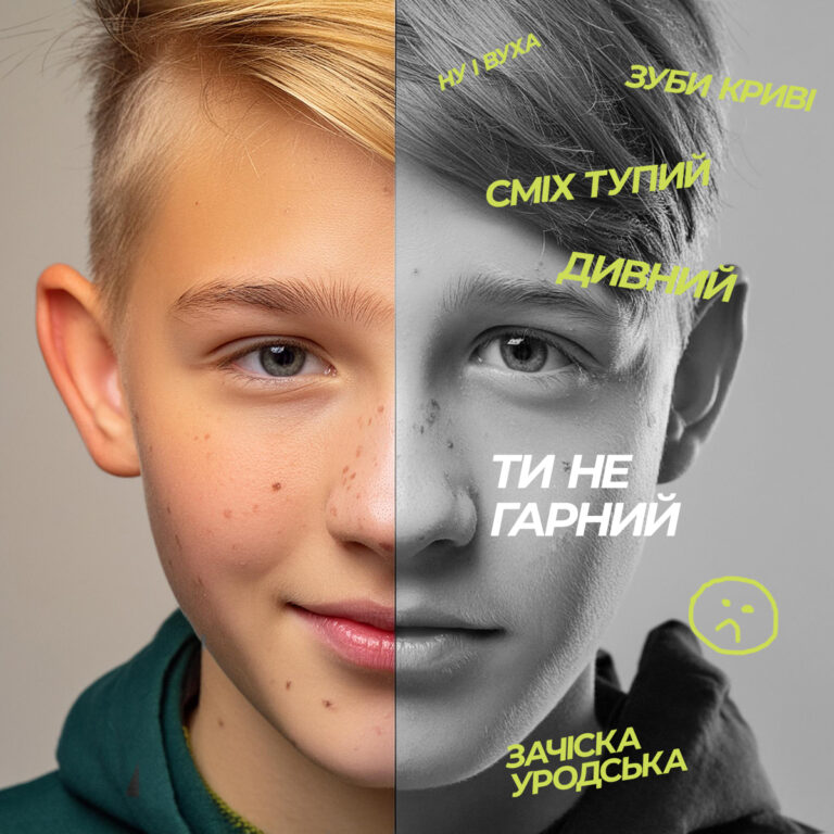 Как убрать прыщи на лице у подростка в домашних условиях