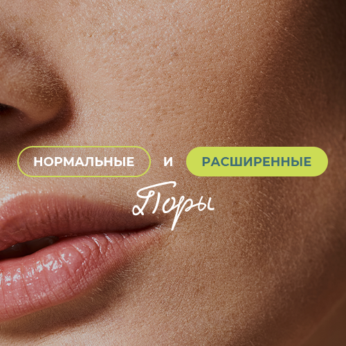 Нормальные и расширенные поры: в чем разница?