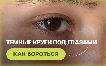 Как бороться с темными кругами под глазами