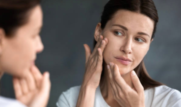 Закриті та відкриті комедони — що це таке і як їх позбутися?