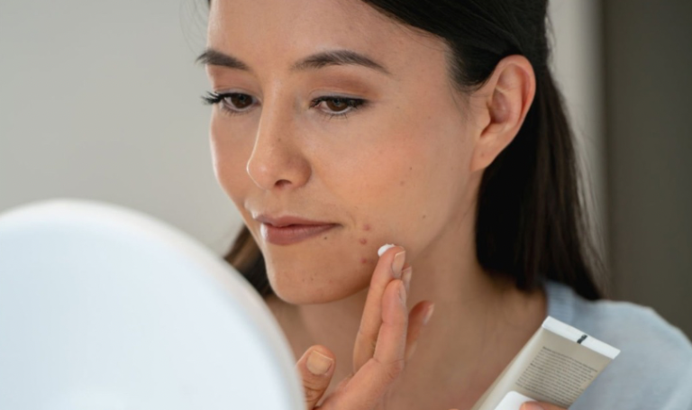 Прищі на підборідді: причини появи та як їх позбутися