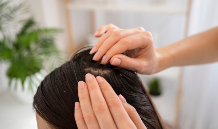 Як позбутися лупи: причини, ефективне лікування та найкращі шампуні