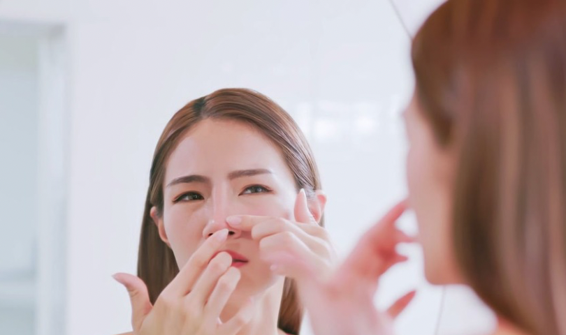 Як позбутися чорних цяток на носі: причини появи та ефективні методи