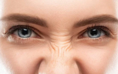 Як прибрати мімічні зморшки?